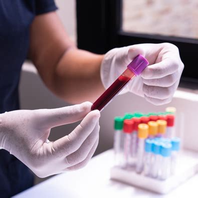 beta-amyloid protein|Blood test can predict presence of beta.